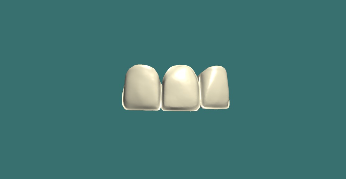 Facial Cutback